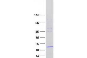 Validation with Western Blot (DNAL1 Protein (Myc-DYKDDDDK Tag))