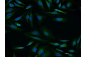 Immunofluorescence (IF) image for anti-serine Peptidase Inhibitor, Kunitz Type, 2 (SPINT2) (AA 1-252) antibody (ABIN948975)