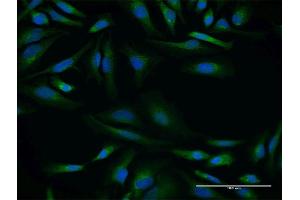 Immunofluorescence of purified MaxPab antibody to SPINT2 on HeLa cell. (SPINT2 Antikörper  (AA 1-252))