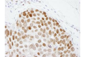 Immunohistochemistry (IHC) image for anti-Chromobox Homolog 3 (CBX3) (C-Term) antibody (ABIN7448460)