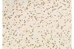 ABIN6265493 and ABIN6279878 at 1/100 staining Rat brain tissue by IHC-P. (TCEAL2 Antikörper)