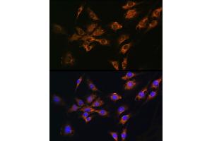 Immunofluorescence analysis of C6 cells using FGF2 Rabbit pAb (ABIN3020744, ABIN3020745, ABIN3020746 and ABIN6213702) at dilution of 1:100 (40x lens). (FGF2 Antikörper  (AA 143-288))