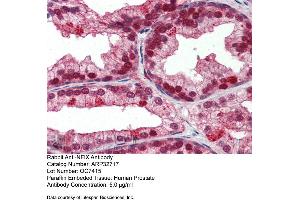 Immunohistochemistry with Human Prostate lysate tissue at an antibody concentration of 5. (NFIX Antikörper  (Middle Region))