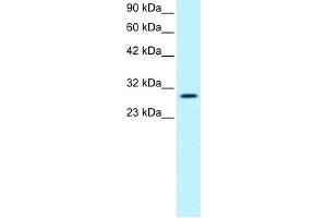 WB Suggested Anti-JMJD8 Antibody Titration:  0. (JMJD8 Antikörper  (Middle Region))