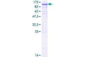 TNNI3K Protein (AA 1-843) (GST tag)