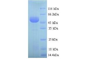 SDS-PAGE (SDS) image for Alanine Glyoxylate Aminotransferase (AGXT) (AA 25-414) protein (His tag) (ABIN5713206)