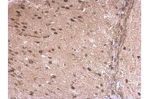 Immunohistochemistry (IHC) image for anti-LIM Domain Binding 1 (LDB1) antibody (ABIN2855846)