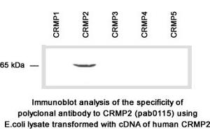 Image no. 2 for anti-Collapsing-Response Mediator Protein 2 (CRMP-2) (C-Term) antibody (ABIN347037) (Collapsing-Response Mediator Protein 2 (CRMP-2) (C-Term) Antikörper)