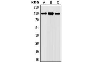 Western blot analysis of JAK1 (pY1022) expression in Ramos (A), Jurkat (B), L929 (C), PC12 (D) whole cell lysates. (JAK1 Antikörper  (C-Term, pTyr1022))