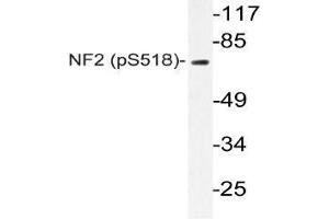 Western blot (WB) analyzes of p-NF2 antibody in extracts from Jurkat IFN cells. (Merlin Antikörper  (pSer518))