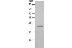 CLEC4A Protein (AA 70-238) (His tag)