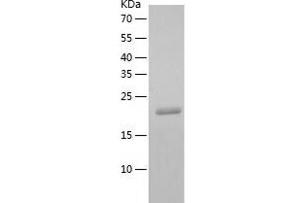 CLEC4A Protein (AA 70-238) (His tag)