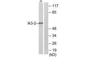 Western blot analysis of extracts from Jurkat cells, using Ik3-2 antibody. (CABLES2 Antikörper)