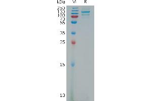 SDS-PAGE (SDS) image for Neuropilin 2 (NRP2) (AA 21-864) protein (His tag) (ABIN7491261)