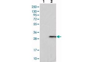 Western blot analysis of Lane 1: Negative control (vector only transfected HEK293T lysate), Lane 2: Over-expression Lysate (Co-expressed with a C-terminal myc-DDK tag (~3. (C1ORF109 Antikörper)