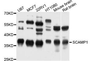 Western blot analysis of extract of various cells, using SCAMP1 antibody. (SCAMP1 Antikörper)