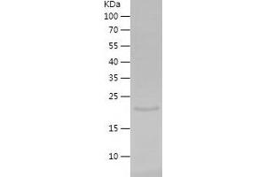 F4/80 Protein (AA 376-506) (His-IF2DI Tag)