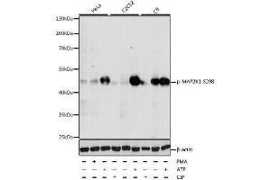 Western blot analysis of extracts of various cell lines, using Phospho-MAP2K1-S298 antibody. (MEK1 Antikörper  (pSer298))