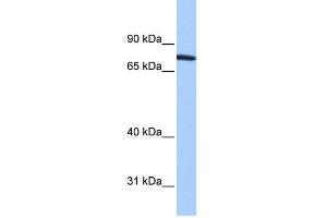 WB Suggested Anti-ZNF45 Antibody Titration:  0. (ZNF45 Antikörper  (N-Term))