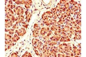 Immunohistochemistry of paraffin-embedded human pancreatic tissue using ABIN7164097 at dilution of 1:100 (PRDM4 Antikörper  (AA 301-500))