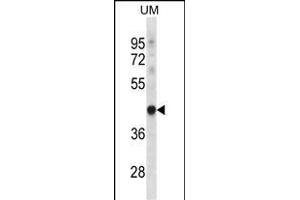 TRUB1 Antibody (Center) (ABIN656716 and ABIN2845945) western blot analysis in uterus tumor cell line lysates (35 μg/lane). (TRUB1 Antikörper  (AA 152-180))