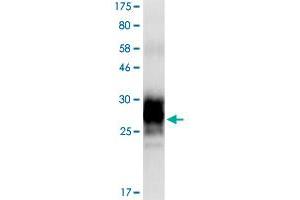 Image no. 1 for Tumor Necrosis Factor Receptor Superfamily, Member 11b (TNFRSF11B) (AA 24-194) protein (His-DYKDDDDK-Strep II Tag) (ABIN1323154) (Osteoprotegerin Protein (AA 24-194) (His-DYKDDDDK-Strep II Tag))