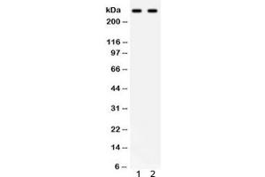 Western blot testing of 1) human HeLa and 2) SW620 lysate with ITPR3 antibody. (ITPR3 Antikörper)