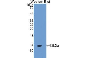 Western Blotting (WB) image for anti-Selectin P (Granule Membrane Protein 140kDa, Antigen CD62) (SELP) (AA 58-158) antibody (ABIN1173198) (P-Selectin Antikörper  (AA 58-158))