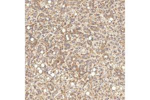 IHC analysis of SGCE using anti-SGCE antibody (ABIN7601544). (SGCE Antikörper  (AA 38-407))