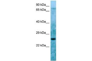 Host: Rabbit Target Name: C11orf48 Sample Type: HepG2 Whole Cell lysates Antibody Dilution: 1. (C11orf48 Antikörper  (C-Term))