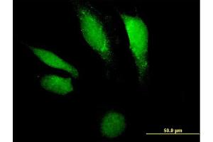 Immunofluorescence of purified MaxPab antibody to DNASE2 on HeLa cell.