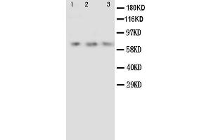 Anti-Angiopoietin 2 antibody, Western blotting Lane 1: Recombinant Human ANG2 Protein 10ng Lane 2: Recombinant Human ANG2 Protein 5ng Lane 3: Recombinant Human ANG2 Protein 2. (Angiopoietin 2 Antikörper  (C-Term))