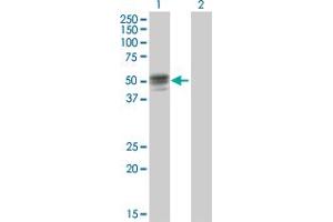 Western Blot analysis of GIF expression in transfected 293T cell line by GIF MaxPab polyclonal antibody. (Intrinsic Factor Antikörper  (AA 1-417))