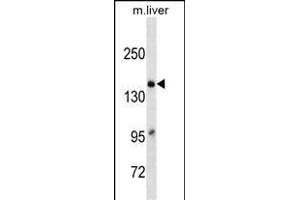 A2M Antibody (C-term)(Ascites) ABIN1539961 western blot analysis in mouse Liver tissue lysates (35 μg/lane). (alpha 2 Macroglobulin Antikörper  (C-Term))