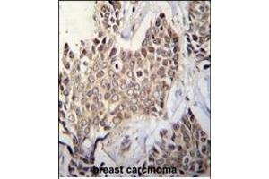 ZBTB42 Antibody (N-term) (ABIN655541 and ABIN2845052) immunohistochemistry analysis in formalin fixed and paraffin embedded human breast tissue followed by peroxidase conjugation of the secondary antibody and DAB staining.
