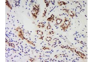 Immunohistochemistry (Paraffin-embedded Sections) (IHC (p)) image for anti-Protein Phosphatase 1, Regulatory (Inhibitor) Subunit 10 (PPP1R10) (AA 151-250) antibody (ABIN1386277)