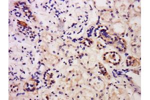 Formalin-fixed and paraffin embedded human kidney labeled with Anti-Caspase-6 Polyclonal Antibody, Unconjugated  at 1:200 followed by conjugation to the secondary antibody and DAB staining. (Caspase 6 Antikörper  (AA 151-250))