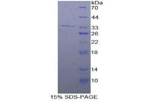 SDS-PAGE (SDS) image for Interferon Regulatory Factor 4 (IRF4) (AA 175-433) protein (His tag) (ABIN2125407)