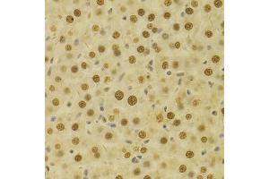 Immunohistochemistry of paraffin-embedded rat liver using HDGF Antibody (ABIN1876535) at dilution of 1:100 (40x lens). (HDGF Antikörper)