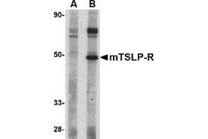 Western blot analysis of TSLP Receptor in mouse heart tissue lysate with this product at 1 μg/ml in (A) the presence and (B) the absence of blocking peptide.