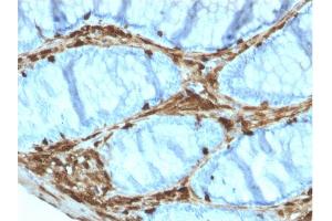 Immunohistochemistry (IHC) image for anti-Annexin A1 (ANXA1) antibody (ABIN6939608)