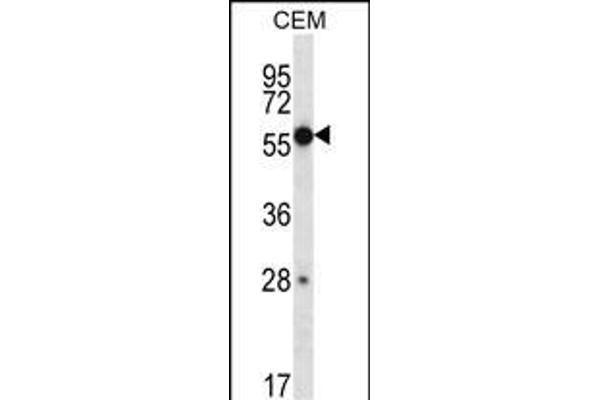 ZNF764 Antikörper  (AA 84-113)