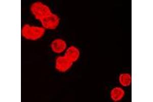 Immunofluorescent analysis of BUB3 staining in HeLa cells.