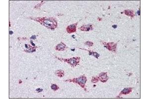 Immunohistochemistry (IHC) image for anti-Cathepsin D (CTSD) (AA 21-412) antibody (ABIN317502) (Cathepsin D Antikörper  (AA 21-412))