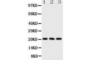 Western Blotting (WB) image for anti-Fibroblast Growth Factor 21 (FGF21) (AA 43-58), (N-Term) antibody (ABIN3044256)