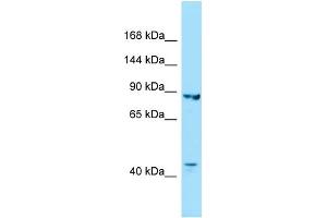 WB Suggested Anti-IPO8 Antibody Titration: 1. (Importin 8 Antikörper  (C-Term))