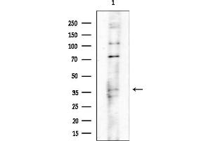 anti-Polymerase (RNA) III (DNA Directed) Polypeptide D, 44kDa (POLR3D) (Internal Region) antibody