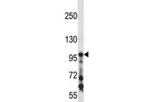 COL1A1 antibody western blot analysis in mouse kidney tissue lysate (COL1A1 Antikörper  (AA 1077-1106))