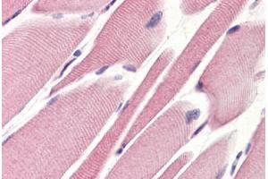 Human Skeletal Muscle (formalin-fixed, paraffin-embedded) stained with STEAP1 antibody ABIN364397 at 10 ug/ml followed by biotinylated anti-mouse IgG secondary antibody ABIN481714, alkaline phosphatase-streptavidin and chromogen. (STEAP1 Antikörper  (AA 1-70))