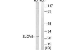 Western blot analysis of extracts from MCF-7 cells, using ELOVL5 antibody. (ELOVL5 Antikörper)